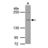 Eps15 Antibody from Signalway Antibody (35458) - Antibodies.com