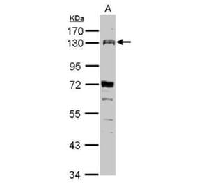 FGFR4 Antibody from Signalway Antibody (35466) - Antibodies.com