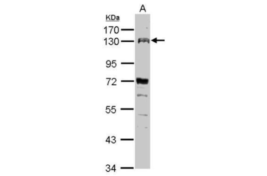 FGFR4 Antibody from Signalway Antibody (35466) - Antibodies.com