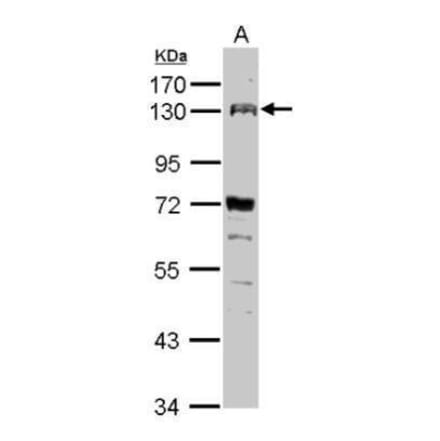 FGFR4 Antibody from Signalway Antibody (35466) - Antibodies.com