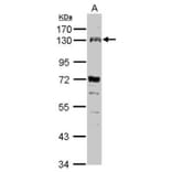 FGFR4 Antibody from Signalway Antibody (35466) - Antibodies.com