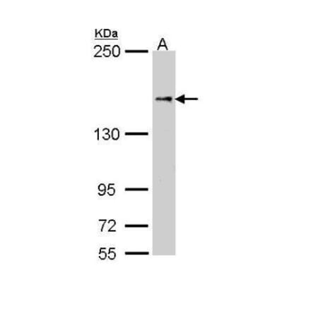 NFAT5 Antibody from Signalway Antibody (35480) - Antibodies.com