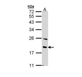 BNIP3 Antibody from Signalway Antibody (35500) - Antibodies.com