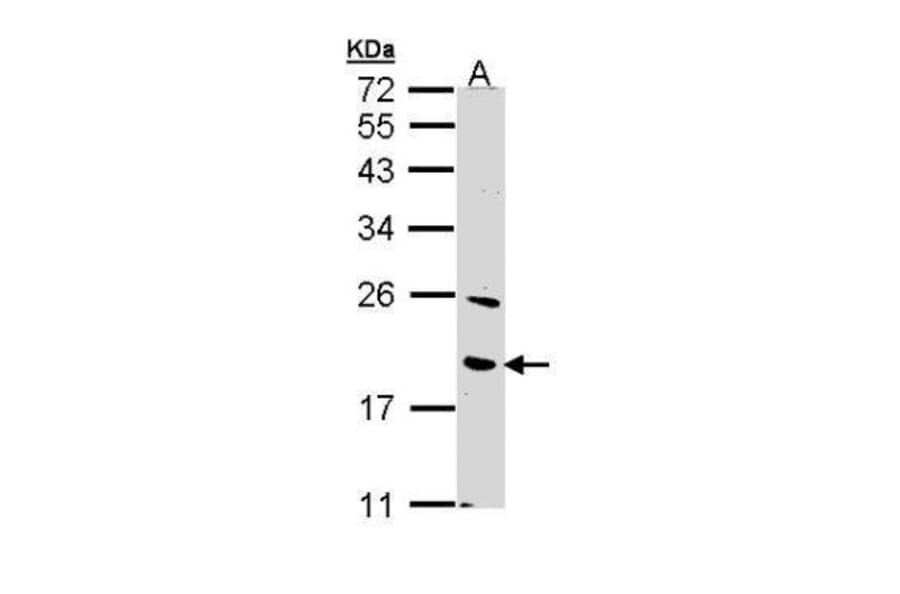 BNIP3 Antibody from Signalway Antibody (35500) - Antibodies.com