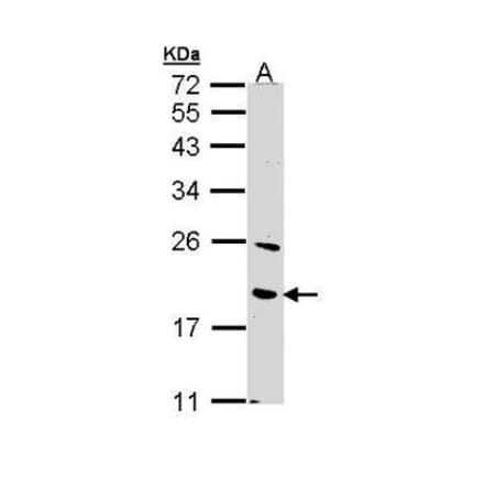 BNIP3 Antibody from Signalway Antibody (35500) - Antibodies.com