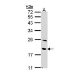 BNIP3 Antibody from Signalway Antibody (35500) - Antibodies.com