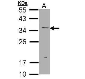 ERCC1 Antibody from Signalway Antibody (35511) - Antibodies.com