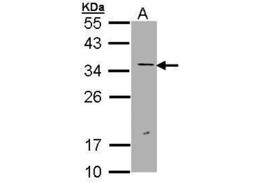ERCC1 Antibody from Signalway Antibody (35511) - Antibodies.com
