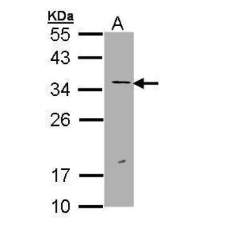 ERCC1 Antibody from Signalway Antibody (35511) - Antibodies.com