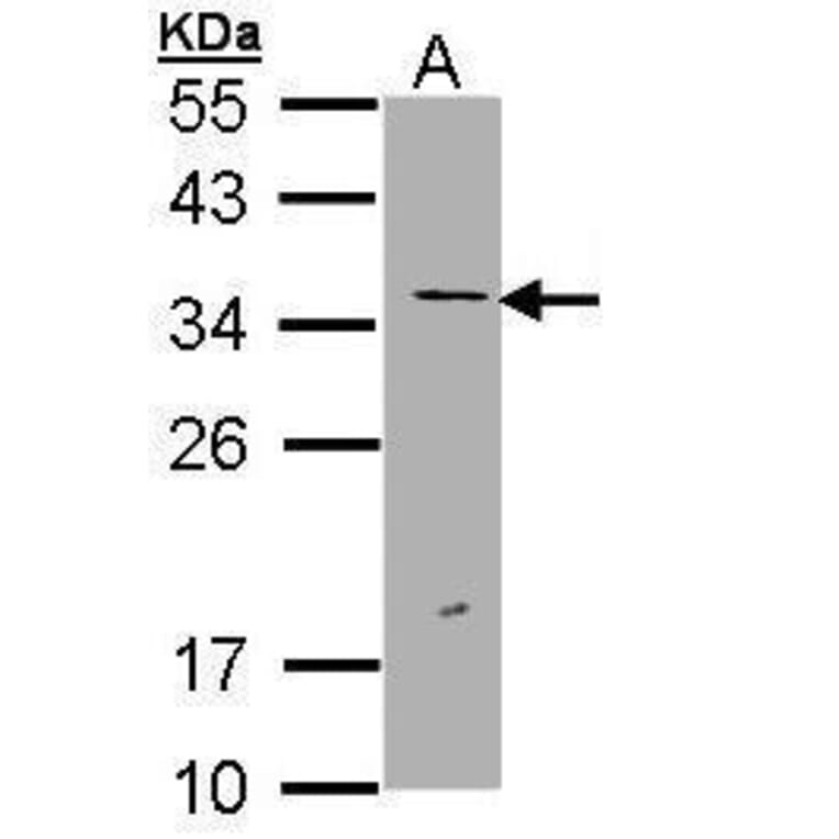 ERCC1 Antibody from Signalway Antibody (35511) - Antibodies.com