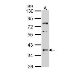 TRADD Antibody from Signalway Antibody (35520) - Antibodies.com
