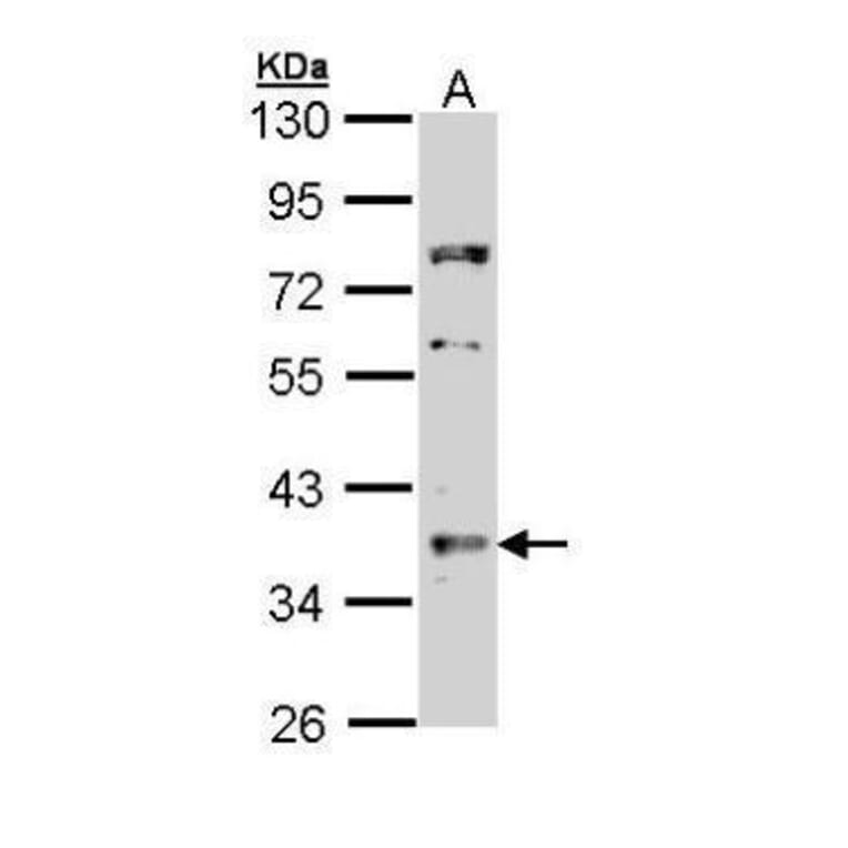 TRADD Antibody from Signalway Antibody (35520) - Antibodies.com