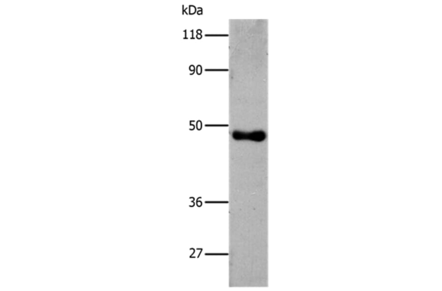 6-His Antibody from Signalway Antibody (35533) - Antibodies.com