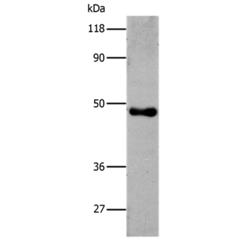 6-His Antibody from Signalway Antibody (35533) - Antibodies.com