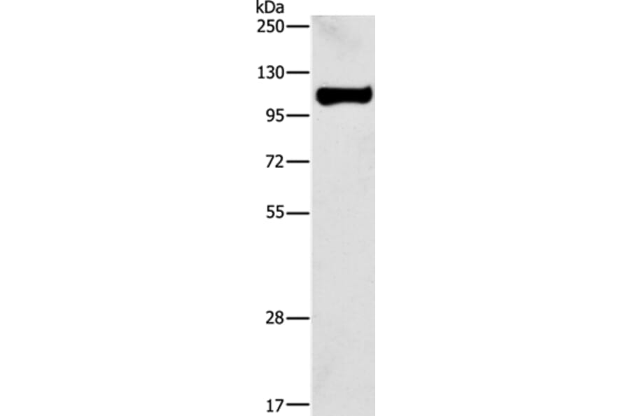 STAT6 Antibody from Signalway Antibody (35574) - Antibodies.com