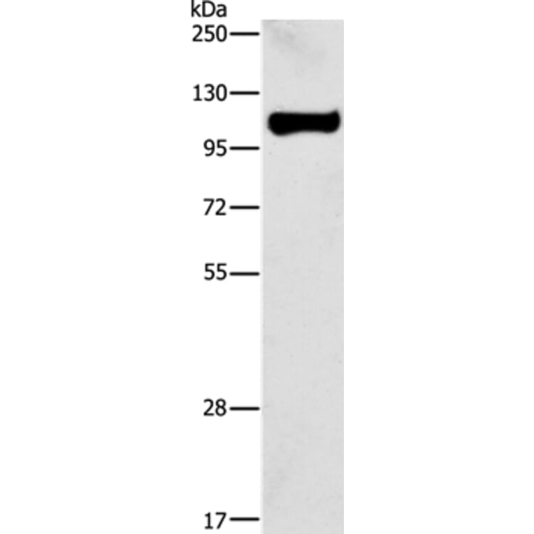 STAT6 Antibody from Signalway Antibody (35574) - Antibodies.com