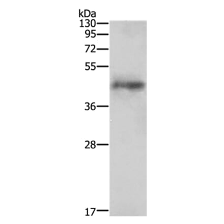 AGTR1 Antibody from Signalway Antibody (35616) - Antibodies.com