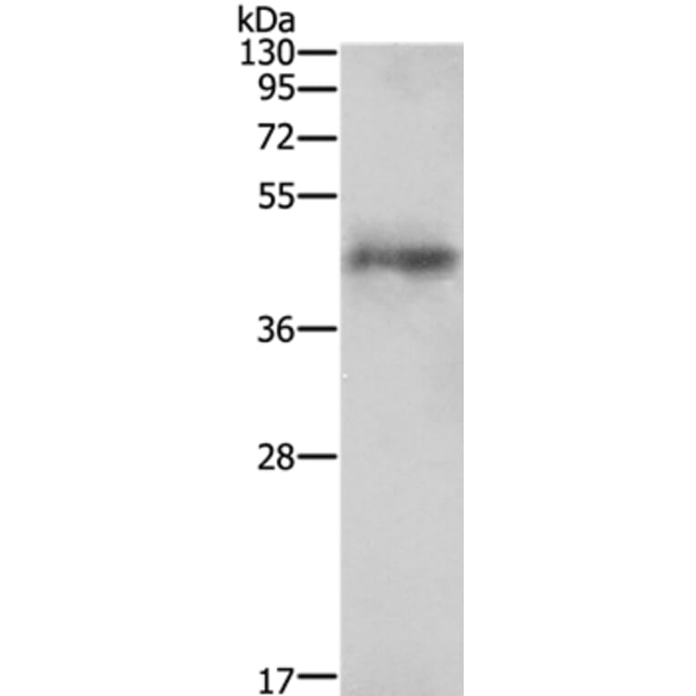 AGTR1 Antibody from Signalway Antibody (35616) - Antibodies.com