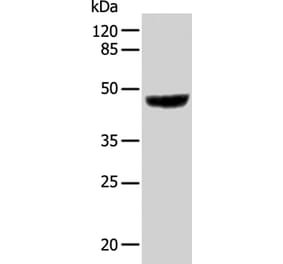KRT31 Antibody from Signalway Antibody (35631) - Antibodies.com
