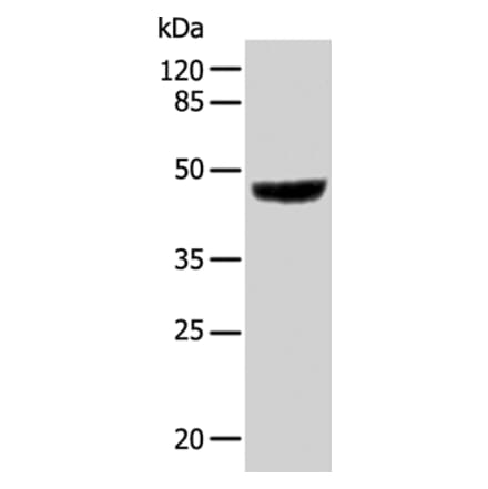 KRT31 Antibody from Signalway Antibody (35631) - Antibodies.com