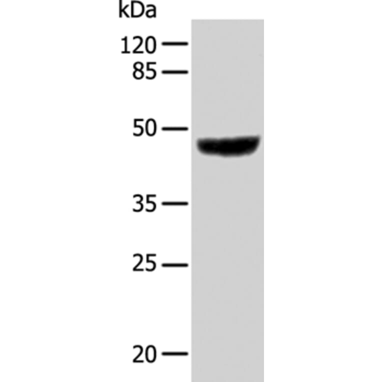 KRT31 Antibody from Signalway Antibody (35631) - Antibodies.com