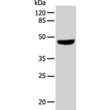 KRT31 Antibody from Signalway Antibody (35631) - Antibodies.com