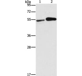 FSCN1 Antibody from Signalway Antibody (35636) - Antibodies.com