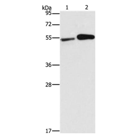 FSCN1 Antibody from Signalway Antibody (35636) - Antibodies.com