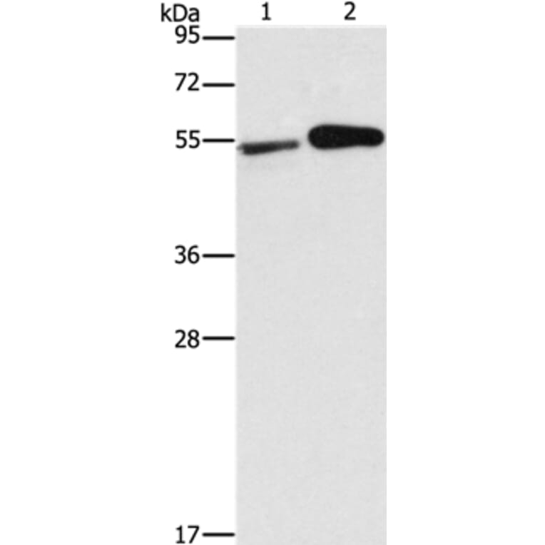 FSCN1 Antibody from Signalway Antibody (35636) - Antibodies.com