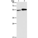 FSCN1 Antibody from Signalway Antibody (35636) - Antibodies.com