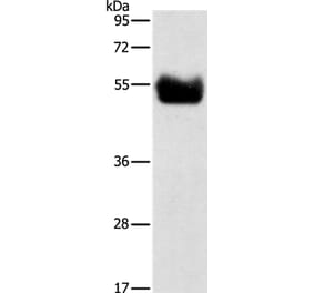 BACE1 Antibody from Signalway Antibody (35650) - Antibodies.com