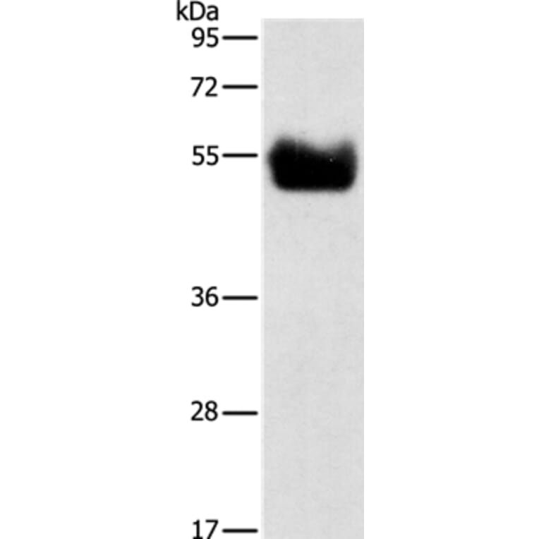 BACE1 Antibody from Signalway Antibody (35650) - Antibodies.com