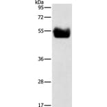 BACE1 Antibody from Signalway Antibody (35650) - Antibodies.com