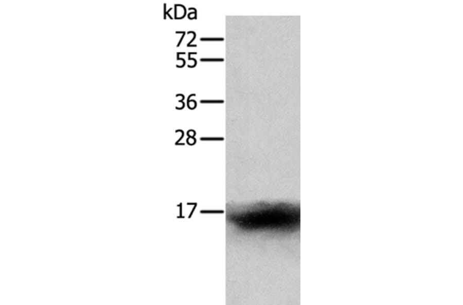 CCL24 Antibody from Signalway Antibody (35671) - Antibodies.com