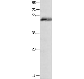 FOSL2 Antibody from Signalway Antibody (35739) - Antibodies.com