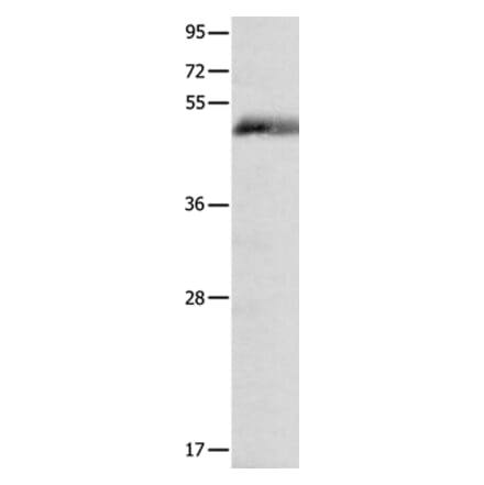 FOSL2 Antibody from Signalway Antibody (35739) - Antibodies.com
