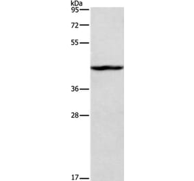 TBX20 Antibody from Signalway Antibody (35742) - Antibodies.com