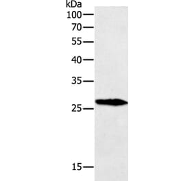 GREM1 Antibody from Signalway Antibody (35761) - Antibodies.com