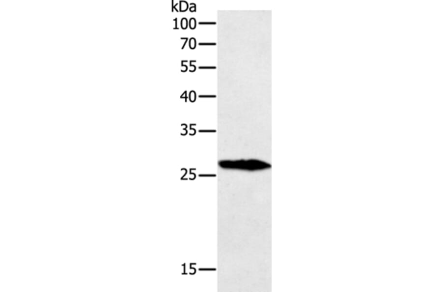 GREM1 Antibody from Signalway Antibody (35761) - Antibodies.com