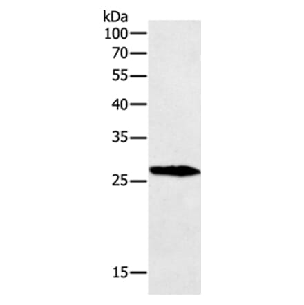 GREM1 Antibody from Signalway Antibody (35761) - Antibodies.com