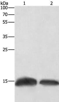 Gel: 12% SDS-PAGE Lysates (from left to right): Human fetal brain tissue and Hela cell Amount of lysate: 20ug per lane Primary antibody: 1/250 dilution Secondary antibody dilution: 1/8000 Exposure time: 10 seconds