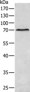 Gel: 10% SDS-PAGE Lysates (from left to right): Human liver cancer tissue Amount of lysate: 40ug per lane Primary antibody: 1/400 dilution Secondary antibody dilution: 1/8000 Exposure time: 30 seconds