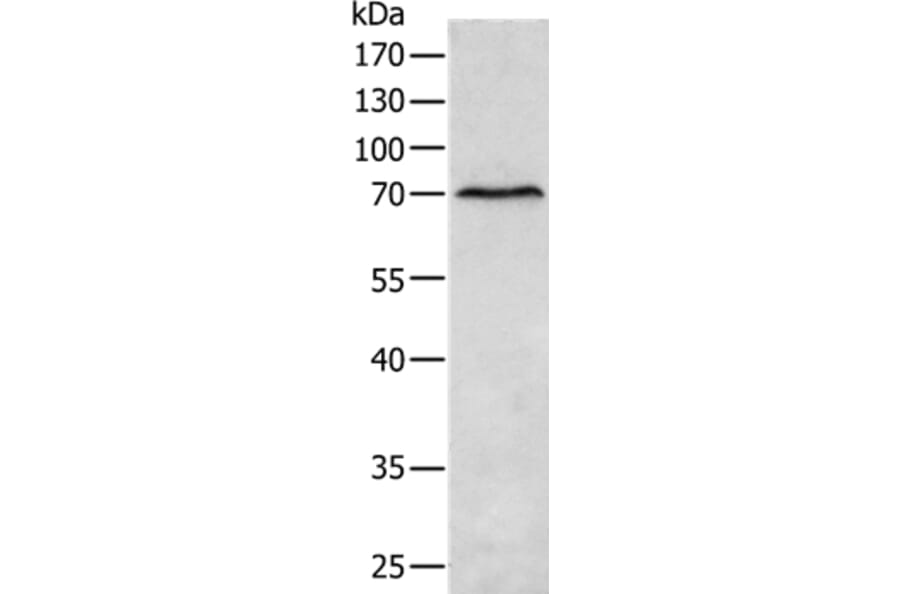 MATN4 Antibody from Signalway Antibody (35810) - Antibodies.com