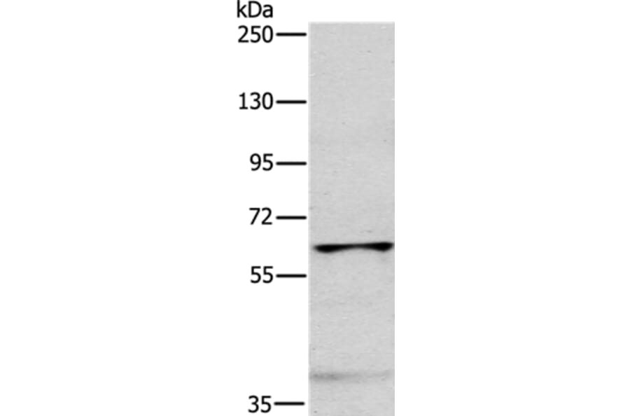 MYLK2 Antibody from Signalway Antibody (35816) - Antibodies.com