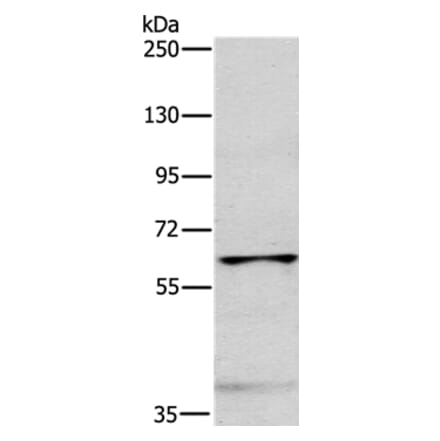 MYLK2 Antibody from Signalway Antibody (35816) - Antibodies.com