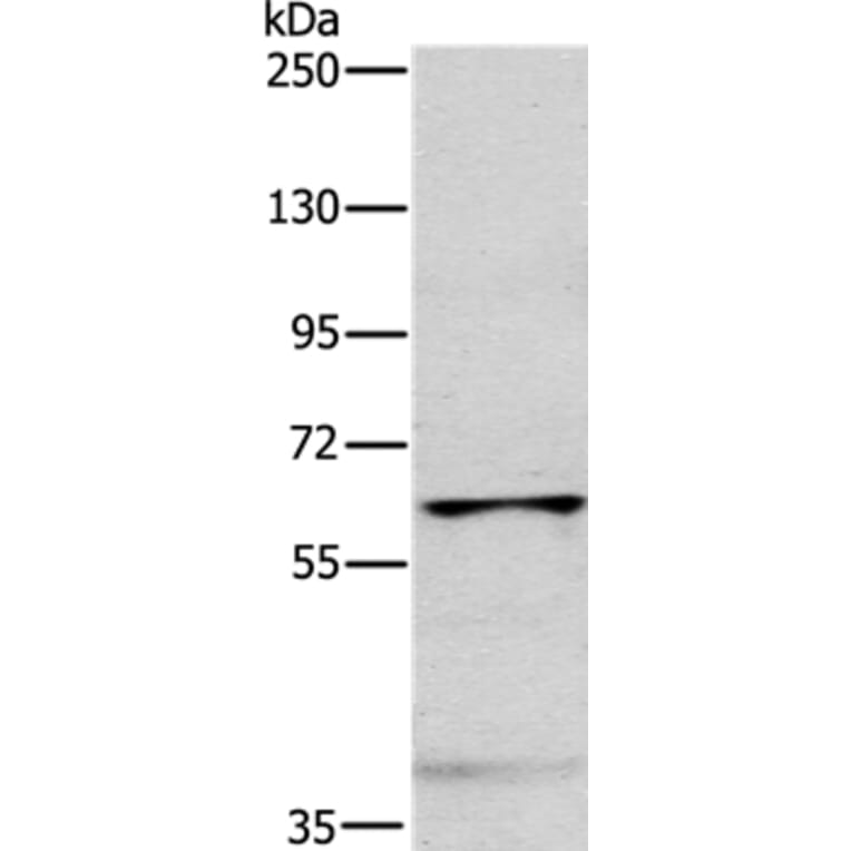 MYLK2 Antibody from Signalway Antibody (35816) - Antibodies.com