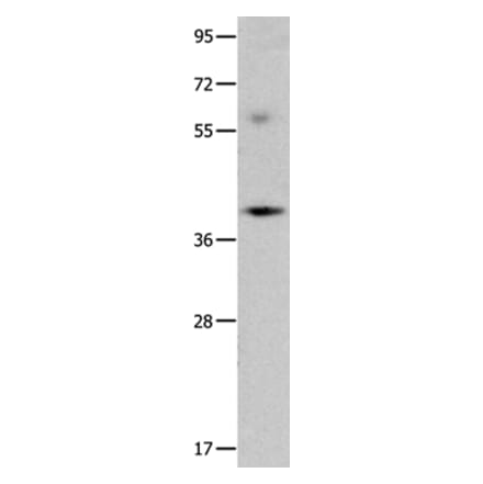 OPCML Antibody from Signalway Antibody (35854) - Antibodies.com