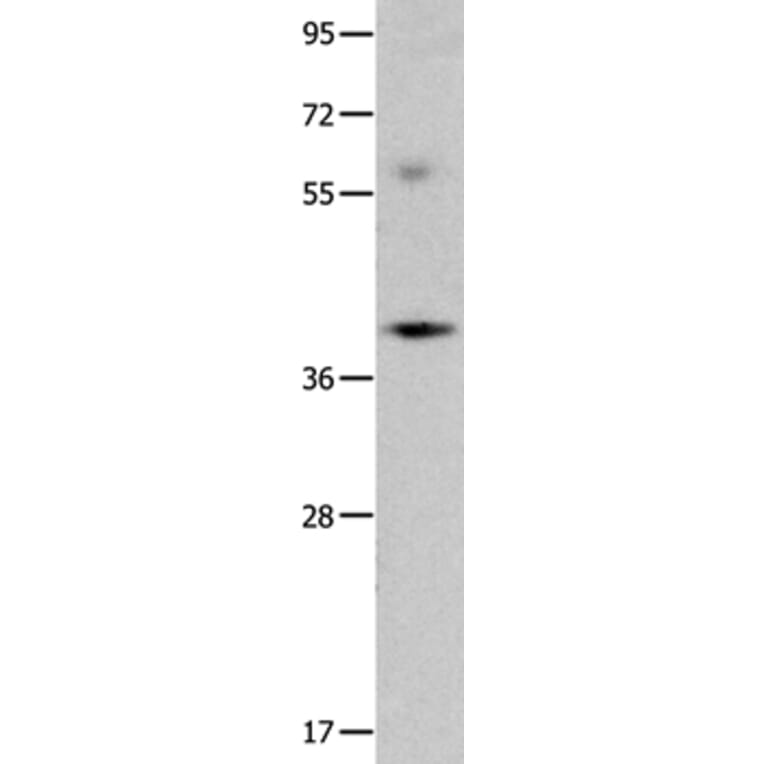 OPCML Antibody from Signalway Antibody (35854) - Antibodies.com