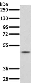Gel: 10% SDS-PAGE Lysate: 60ug K562 cell Primary antibody: 1/300 dilution Secondary antibody dilution: 1/8000 Exposure time: 10 minutes