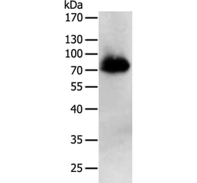 PRMT7 Antibody from Signalway Antibody (35889) - Antibodies.com